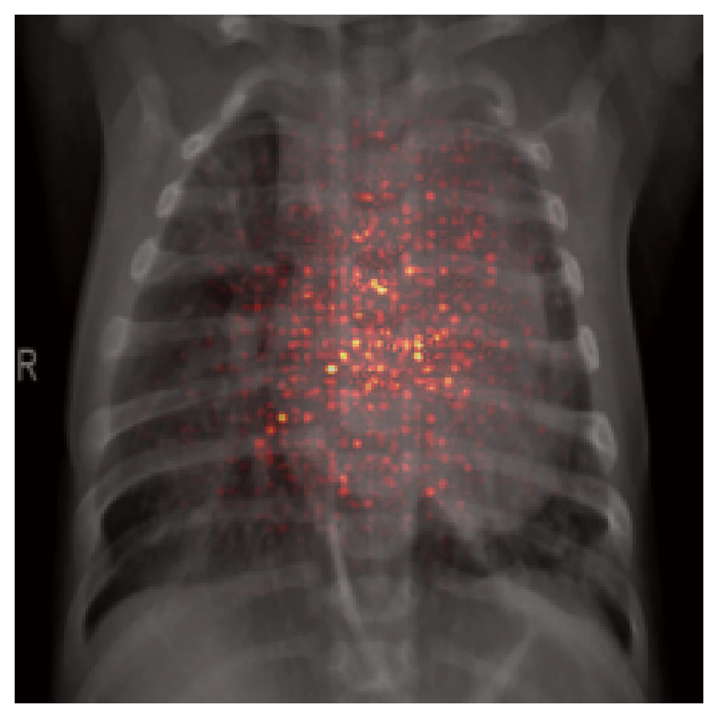 Effective receptive field at layer3, scattered across the central chest cavity but still concentrated.
