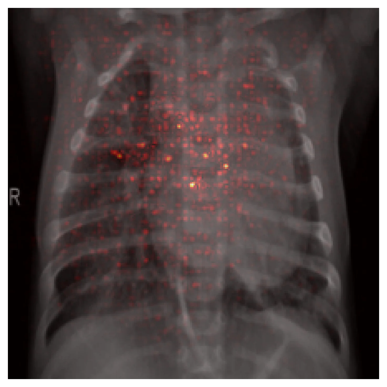 Effective receptive field at layer4, spread broadly across most of the chest area.