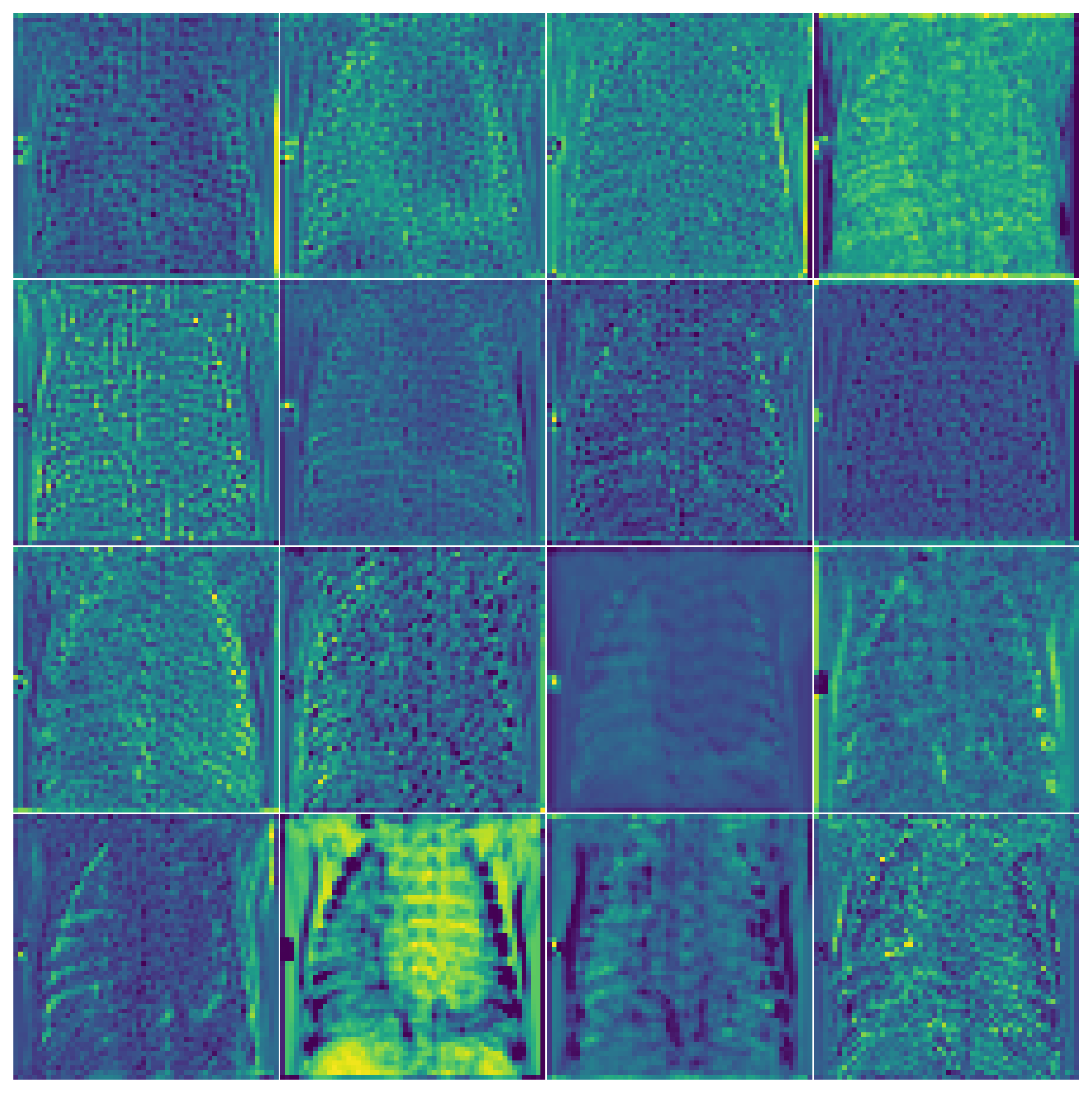 A grid of 16 channel activation maps from ResNet50 layer1, with spatial detail still visible — ribs, chest cavity, the side marker.