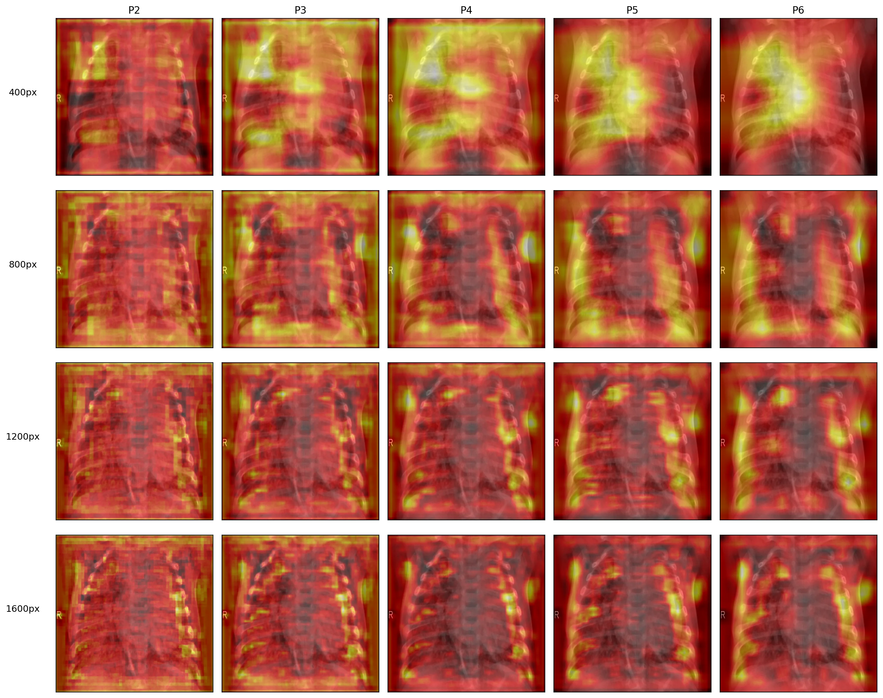 A 4-by-5 grid showing FPN pyramid heatmaps (P2 through P6) for the same chest X-ray at input resolutions of 400, 800, 1200, and 1600 pixels. As input resolution increases, more anatomical detail survives into the deeper pyramid levels.
